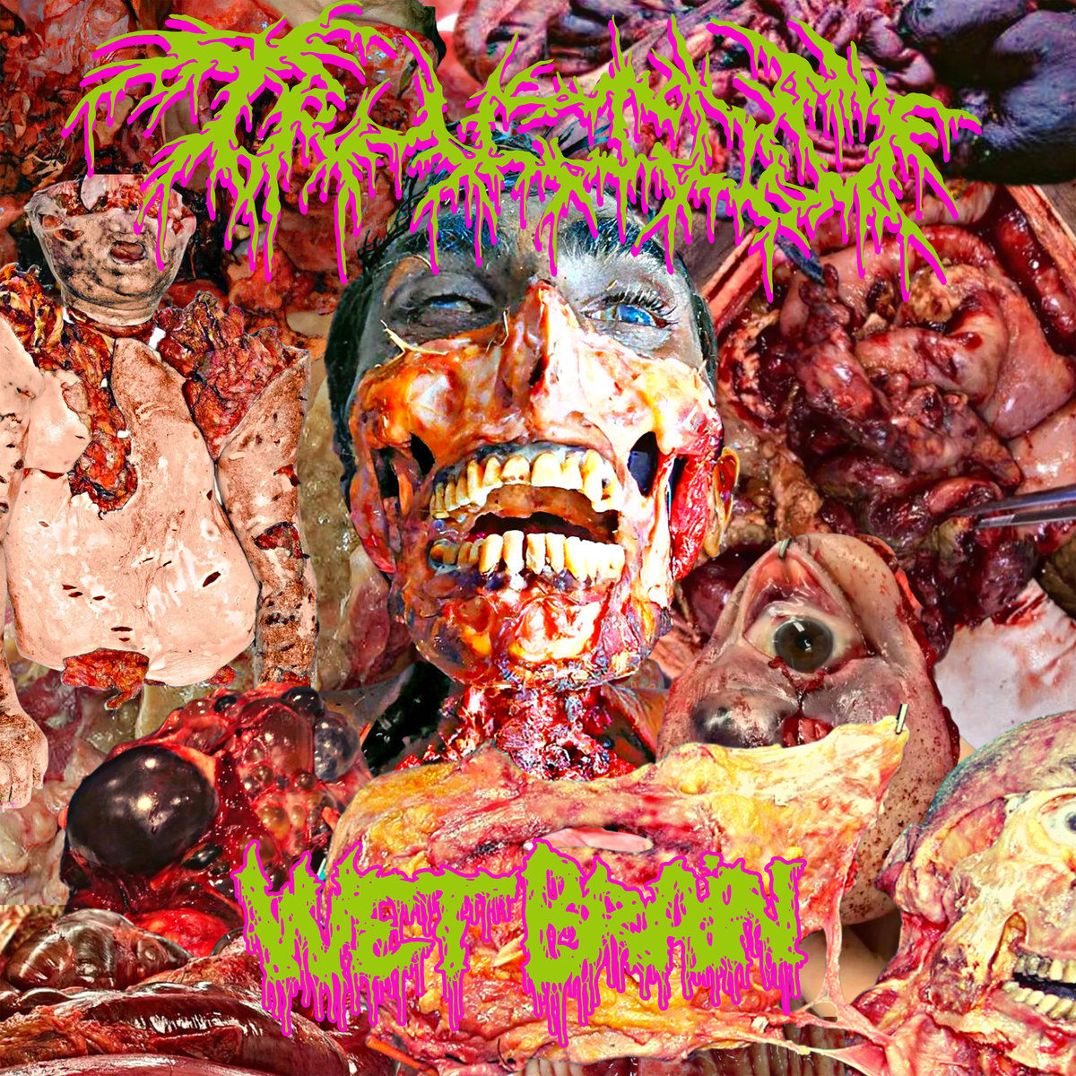 WET BRAIN Split W/Deterioration