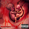 Abortion