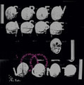 Split with V0NT