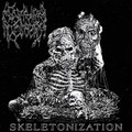 Skeletonization