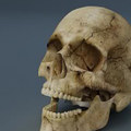 Crack Your Skull